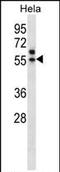 Transcriptional Adaptor 3 antibody, PA5-35154, Invitrogen Antibodies, Western Blot image 