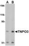 Transportin 3 antibody, LS-C53297, Lifespan Biosciences, Western Blot image 