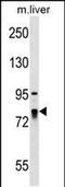 La Ribonucleoprotein Domain Family Member 4 antibody, PA5-48876, Invitrogen Antibodies, Western Blot image 