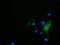 Histone Deacetylase 6 antibody, MA5-25326, Invitrogen Antibodies, Immunocytochemistry image 
