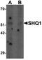 SHQ1, H/ACA Ribonucleoprotein Assembly Factor antibody, A10185, Boster Biological Technology, Western Blot image 