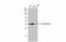 Tropomyosin 1 antibody, GTX113857, GeneTex, Western Blot image 