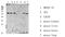 Receptor Interacting Serine/Threonine Kinase 2 antibody, STJ99600, St John