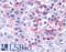 Transient Receptor Potential Cation Channel Subfamily V Member 4 antibody, LS-A8583, Lifespan Biosciences, Immunohistochemistry paraffin image 