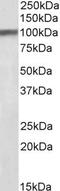 Huntingtin Associated Protein 1 antibody, EB07787, Everest Biotech, Western Blot image 