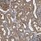 HtrA Serine Peptidase 3 antibody, NBP1-87211, Novus Biologicals, Immunohistochemistry frozen image 