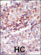 TEK Receptor Tyrosine Kinase antibody, 63-140, ProSci, Immunohistochemistry paraffin image 