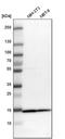 Translocase Of Outer Mitochondrial Membrane 20 antibody, PA5-52843, Invitrogen Antibodies, Western Blot image 