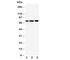 Glucuronidase Beta antibody, R31016, NSJ Bioreagents, Western Blot image 