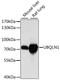 Ubiquilin-1 antibody, A15439, ABclonal Technology, Western Blot image 