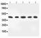 Mitogen-Activated Protein Kinase Kinase 4 antibody, PA2275, Boster Biological Technology, Western Blot image 