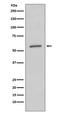 Serum/Glucocorticoid Regulated Kinase 1 antibody, M00673, Boster Biological Technology, Western Blot image 