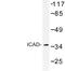 DNA Fragmentation Factor Subunit Alpha antibody, LS-C176879, Lifespan Biosciences, Western Blot image 