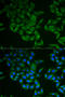 CD247 Molecule antibody, STJ22982, St John