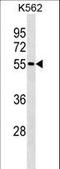 Estrogen Receptor 2 antibody, LS-C159571, Lifespan Biosciences, Western Blot image 