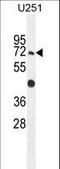 Glycosylphosphatidylinositol Anchor Attachment 1 antibody, LS-C166593, Lifespan Biosciences, Western Blot image 