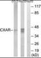 CXADR Ig-Like Cell Adhesion Molecule antibody, orb137231, Biorbyt, Western Blot image 