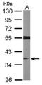 Ras association domain-containing protein 2 antibody, NBP1-32571, Novus Biologicals, Western Blot image 