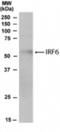 Interferon Regulatory Factor 6 antibody, NBP1-51911, Novus Biologicals, Western Blot image 