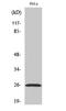 Ephrin A5 antibody, STJ92958, St John