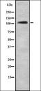 Collagen Like Tail Subunit Of Asymmetric Acetylcholinesterase antibody, orb337320, Biorbyt, Western Blot image 