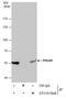 Phosphoglycerate Dehydrogenase antibody, GTX101948, GeneTex, Immunoprecipitation image 