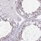 DDX39A antibody, NBP2-46824, Novus Biologicals, Immunohistochemistry paraffin image 