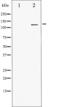 Platelet Derived Growth Factor Receptor Alpha antibody, abx011954, Abbexa, Western Blot image 