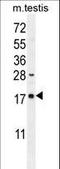 DNA Damage Inducible Transcript 3 antibody, LS-C167320, Lifespan Biosciences, Western Blot image 