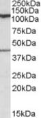 Component Of Oligomeric Golgi Complex 1 antibody, MBS421832, MyBioSource, Western Blot image 