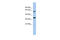 Calcium Homeostasis Modulator 3 antibody, 31-323, ProSci, Western Blot image 