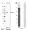 MET Transcriptional Regulator MACC1 antibody, PA5-54139, Invitrogen Antibodies, Western Blot image 