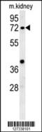 Kelch Like Family Member 6 antibody, 62-050, ProSci, Western Blot image 