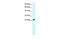 MYST/Esa1 Associated Factor 6 antibody, GTX47769, GeneTex, Western Blot image 