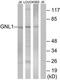 G Protein Nucleolar 1 (Putative) antibody, TA313936, Origene, Western Blot image 