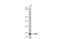 Ribonucleotide Reductase Catalytic Subunit M1 antibody, GTX636579, GeneTex, Western Blot image 