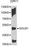 Golgi Membrane Protein 1 antibody, A12584, ABclonal Technology, Western Blot image 