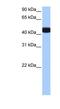 Branched Chain Keto Acid Dehydrogenase Kinase antibody, NBP1-57574, Novus Biologicals, Western Blot image 