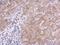 Kelch Like Family Member 21 antibody, GTX120580, GeneTex, Immunohistochemistry paraffin image 