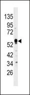 Dual Specificity Phosphatase 4 antibody, LS-C101029, Lifespan Biosciences, Western Blot image 