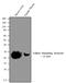 Follicle Stimulating Hormone Subunit Beta antibody, MA5-14726, Invitrogen Antibodies, Western Blot image 