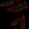Gem Nuclear Organelle Associated Protein 6 antibody, NBP2-58682, Novus Biologicals, Immunocytochemistry image 