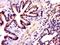 Microtubule Associated Protein 1 Light Chain 3 Alpha antibody, orb69520, Biorbyt, Immunohistochemistry paraffin image 