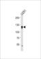 Endothelin-converting enzyme 2 antibody, 60-991, ProSci, Western Blot image 