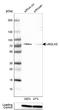 Ubiquilin 2 antibody, NBP1-85639, Novus Biologicals, Western Blot image 