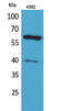 Cytochrome P450 Family 11 Subfamily A Member 1 antibody, STJ96588, St John