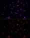 Poly(ADP-Ribose) Polymerase 1 antibody, GTX33387, GeneTex, Immunofluorescence image 