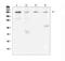 Transient Receptor Potential Cation Channel Subfamily M Member 7 antibody, A00789-1, Boster Biological Technology, Western Blot image 