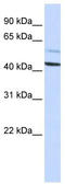 Proteasome 26S Subunit, Non-ATPase 4 antibody, TA344472, Origene, Western Blot image 