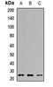 TPPP antibody, LS-C668437, Lifespan Biosciences, Western Blot image 